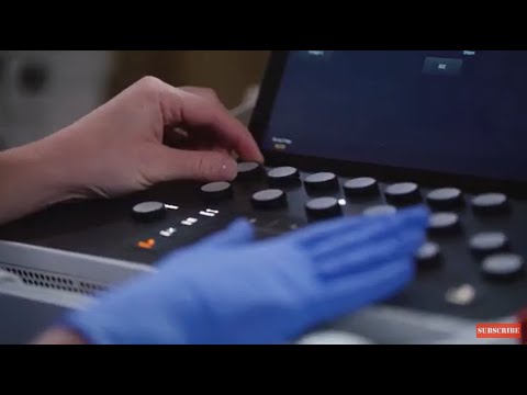 
                  
                    Load and play video in Gallery viewer, Ultrasound
                  
                